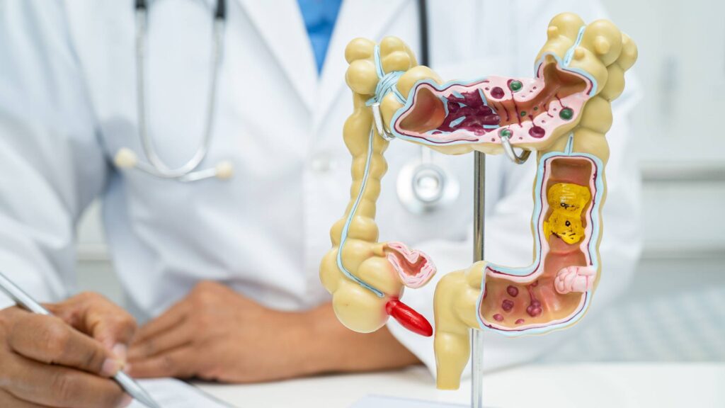 intestine appendix and digestive system doctor