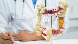 intestine appendix and digestive system doctor