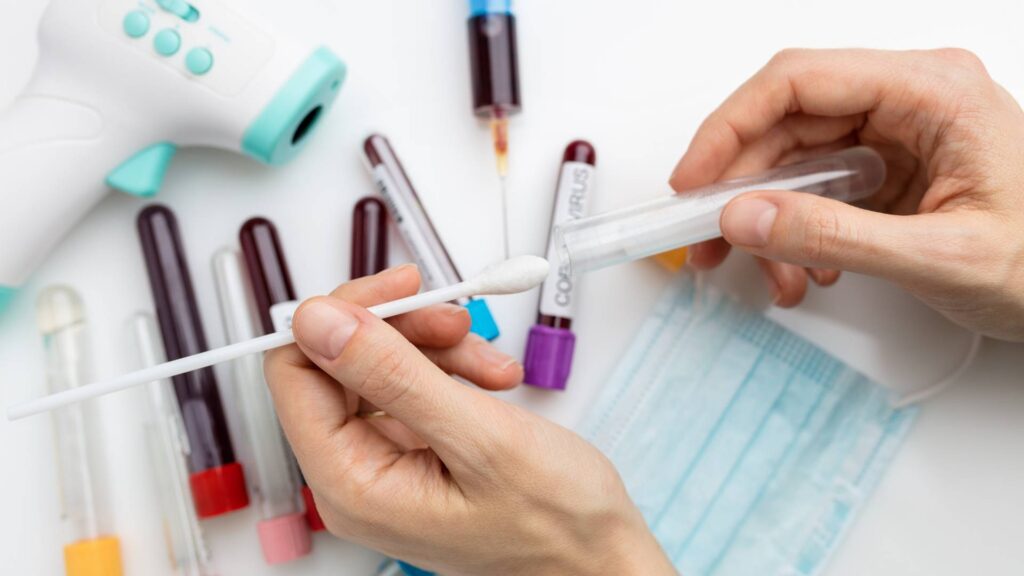 laboratory sample of the novel coronavirus 2023